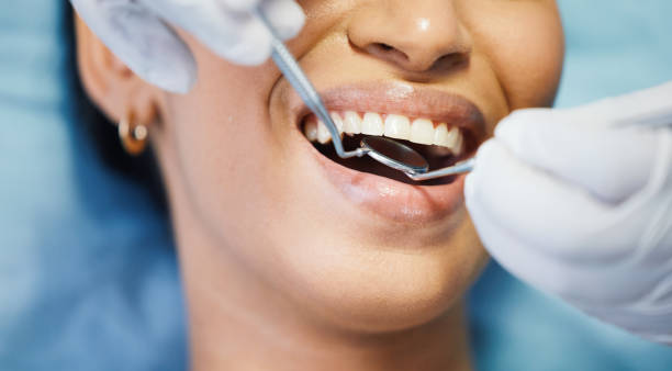 Best Chipped Tooth Repair Near Me  in Fairmont City, IL